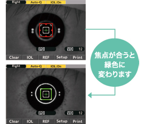 Newly designed IOL Mode [color focus indicator]